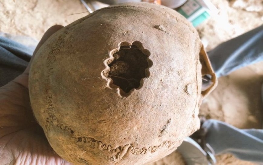 Li Wanê beriya 3 hezar salan emeliyata mêjî hatiye kirin
