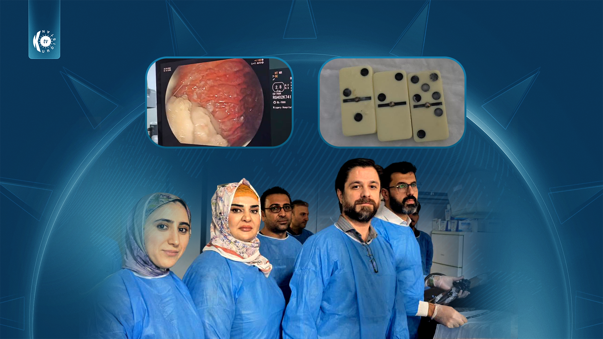 لە گەدەی مێرمنداڵێکی 16 ساڵان 3 پوولی دۆمینە دەرهێنران